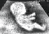 ultrasound.gif
